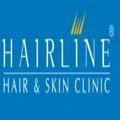 Hairline