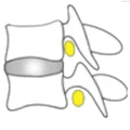 MedSpine