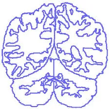 Neuromorphometrics logo