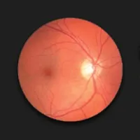 Ophthalmic Instruments logo