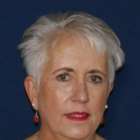 Linda Wynn