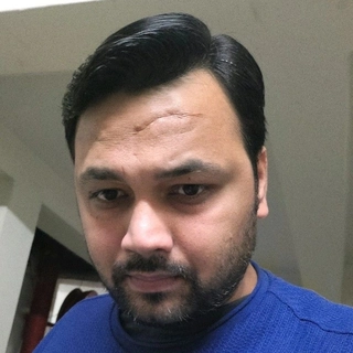 Pawan Kumar